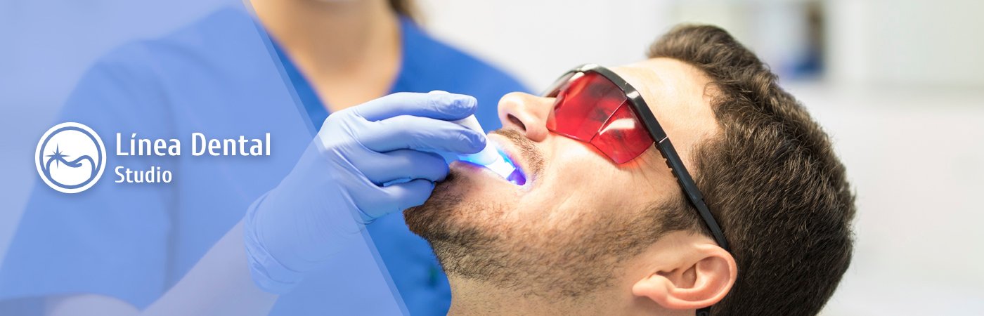 Clareamento - Línea Dental Studio - Avenida Paulista
